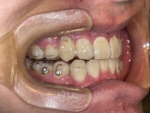 秋葉原リヨンドール歯列矯正歯科クリニック 矯正歯科マウスピース矯正インビザライン 矯正専門医