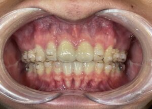 秋葉原リヨンドール歯列矯正歯科クリニック 矯正専門医 マウスピース矯正 インビザライン