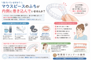 秋葉原リヨンドール歯列矯正歯科クリニック インビザライン エンジェルアライナー マウスピース矯正 矯正専門医