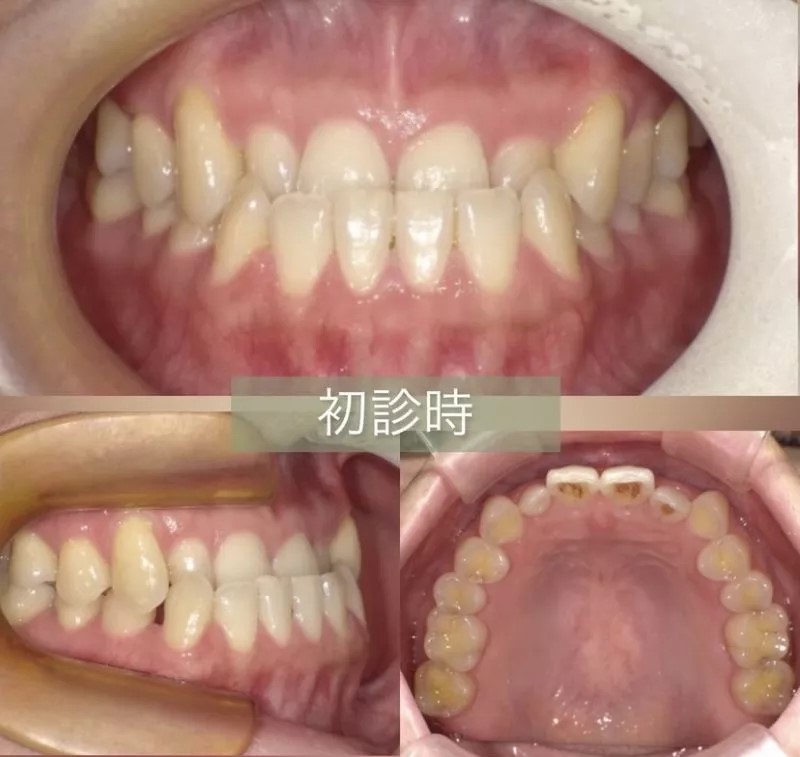 秋葉原リヨンドール歯列矯正歯科クリニック インビザライン専門 マウスピース矯正 矯正専門医