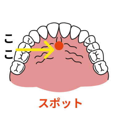 MFT 矯正歯科 矯正専門医